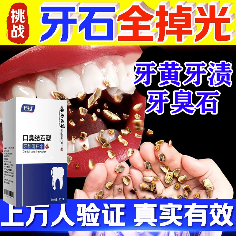 牙结石去除器溶解除牙石非速效漱口水洗牙齿污垢牙黄牙垢清除神器,洗护清洁剂/卫生巾/纸/香薰,口鼻清洁杀菌消炎剂,淘宝优惠券,粉丝福利购,淘宝优惠卷