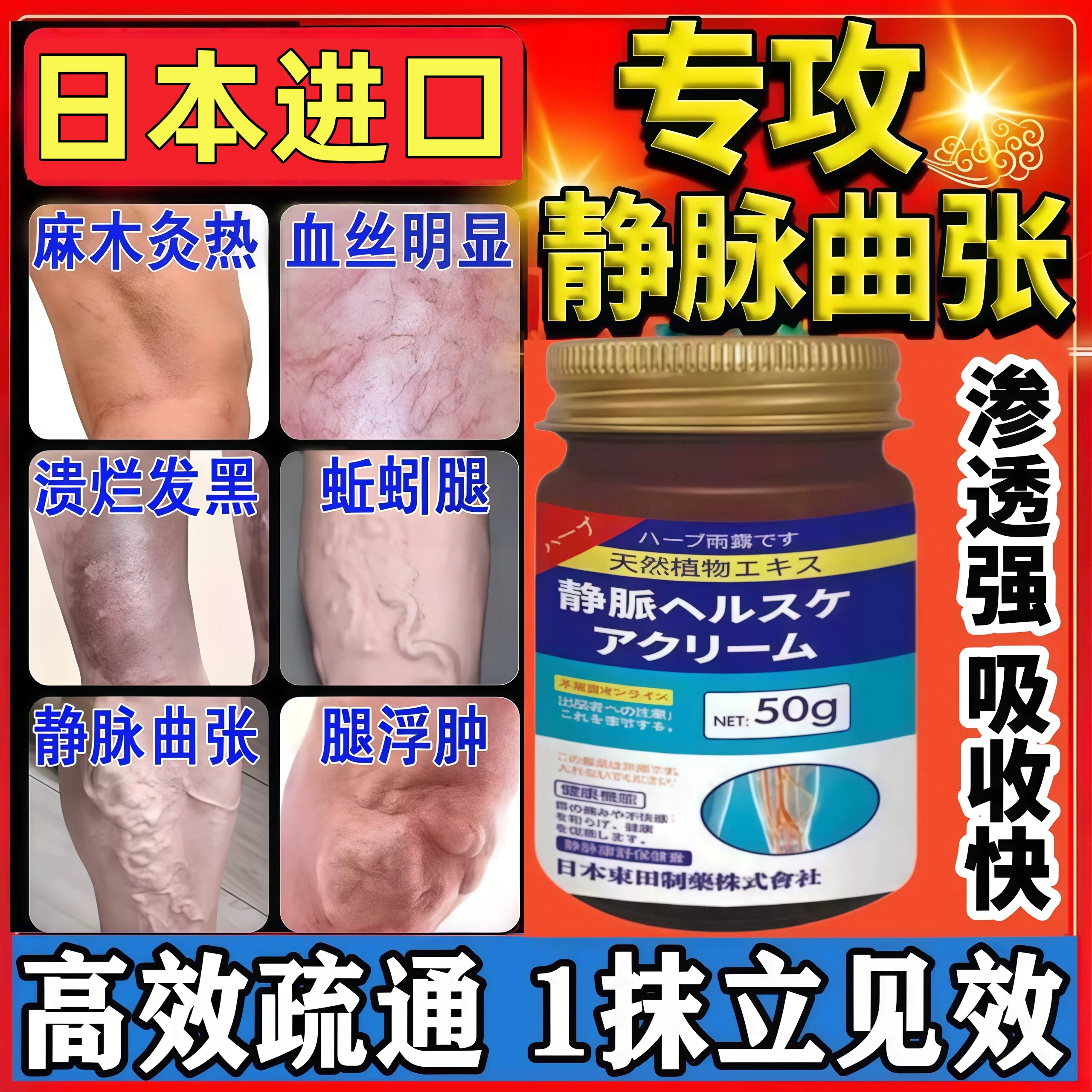 日本进口静脉曲张特效专用治小腿青筋疗凸起蚯蚓腿药老烂腿正品膏