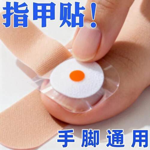 指甲贴正品专用贴灰趾贴植物萃取脚趾手指甲贴专用
