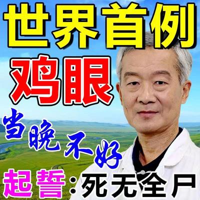 鸡眼膏贴鸡眼药水去/根肉刺去除足部脚趾老茧走路疼下地疼专用