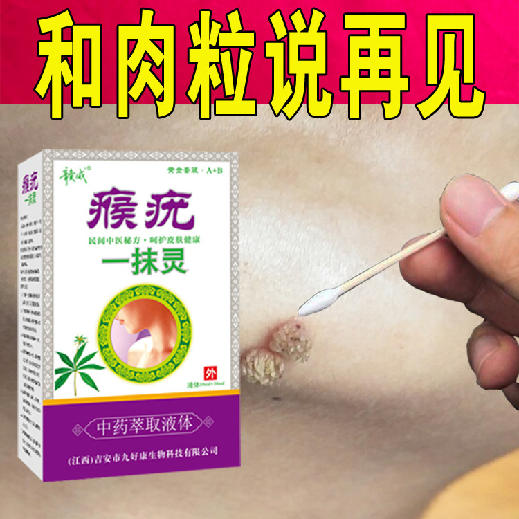 【猴疣一抹灵】去猴子肉粒疙瘩肉刺疣瘊子神器脖子液下肉粒