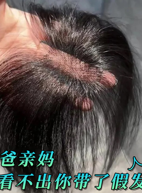 胎毛刘海假发女片头顶遮秃顶神器高颅顶蓬松真发无痕发际线假发贴