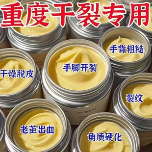 脚后跟干裂修复霜皲裂脚裂手指裂口防干燥起皮足底皴裂马油膏冬季