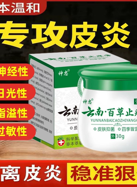 治神经性日光性脂溢性皮炎止痒膏
