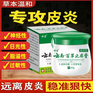 神经性皮炎去祛除外用膏治紫外线过敏疗根日光性皮炎脂溢性皮炎