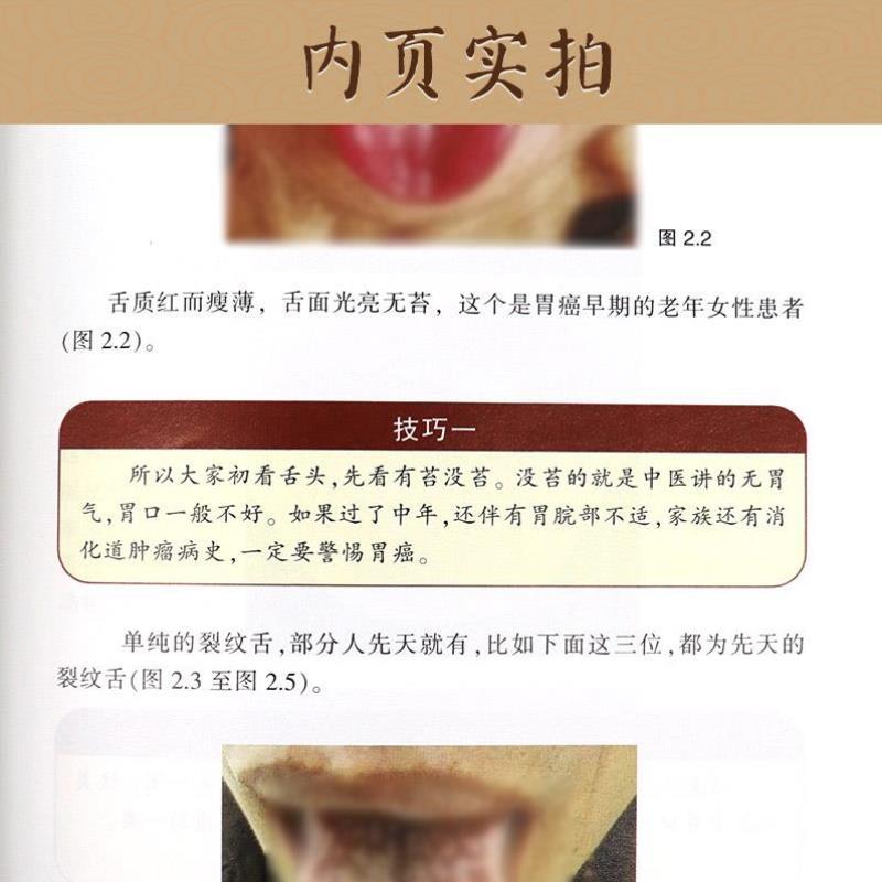 （正版）临证舌诊录 张坚编著 舌诊书图解舌诊断病伸伸舌头把病解入门图谱教程中医养生书籍舌像舌苔辨析临床病症望舌诊病天津科技