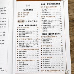 (正版)图解针灸大全/中医经络穴位书针炙学全书入门刺血疗法全一针疗法马氏温灸法黄帝内针灸绳基本功大成甲乙经针灸秘验与绝招