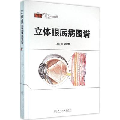 立体眼底病图谱 人民卫生出版社 闵寒毅 主编 著
