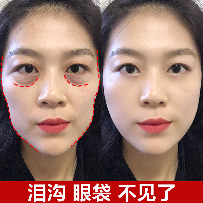 【拒绝填充！】去泪沟神器 不要凹陷脸~眼部丰盈精华液 买2送1