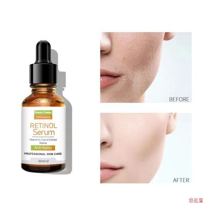Hyaluronic acid, vitamin nicotinamide, retinol essence