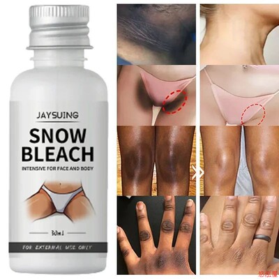 Whitening Cream For Dark Skin Armpit Thigh Inner Joint Light