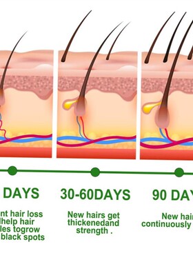 EELHOE Rosemary Serum Hair Growth Care Oil Nourishes Scalp