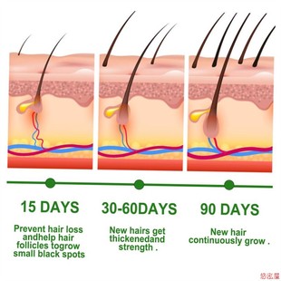 Hair Growth Care EELHOE Nourishes Serum Oil Scalp Rosemary