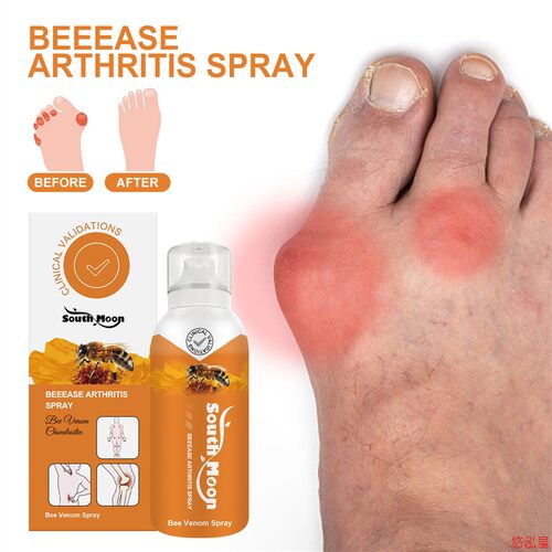 Joint repair spray pain relief Shoulders waist feet