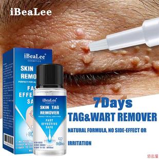7Days Skin Tag Removal Serum Warts Remover Pen Painless Papi