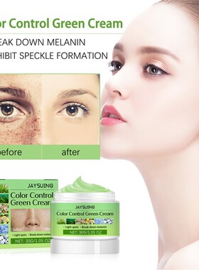 Whitening Freckles Cream Remove Melasma Dark Spot Lightening