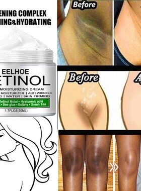 Body Whitening Cream Brightening Skin Tone Improve Dullness