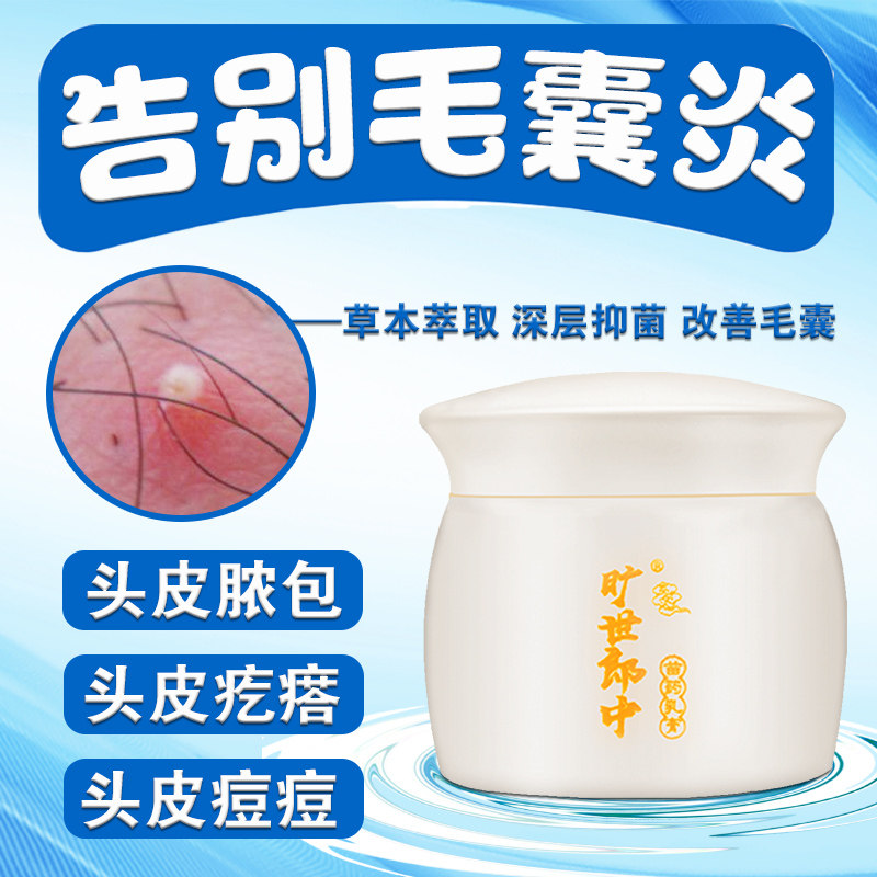 毛囊炎专用薬膏头痒头皮长加慧旷世郎中背部脸部头部身体外用乳膏