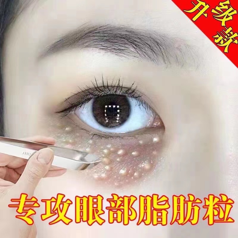 牛油果眼霜去脂肪粒平疣眼部专用神器金霉素眼膏点汗管瘤药水抑菌