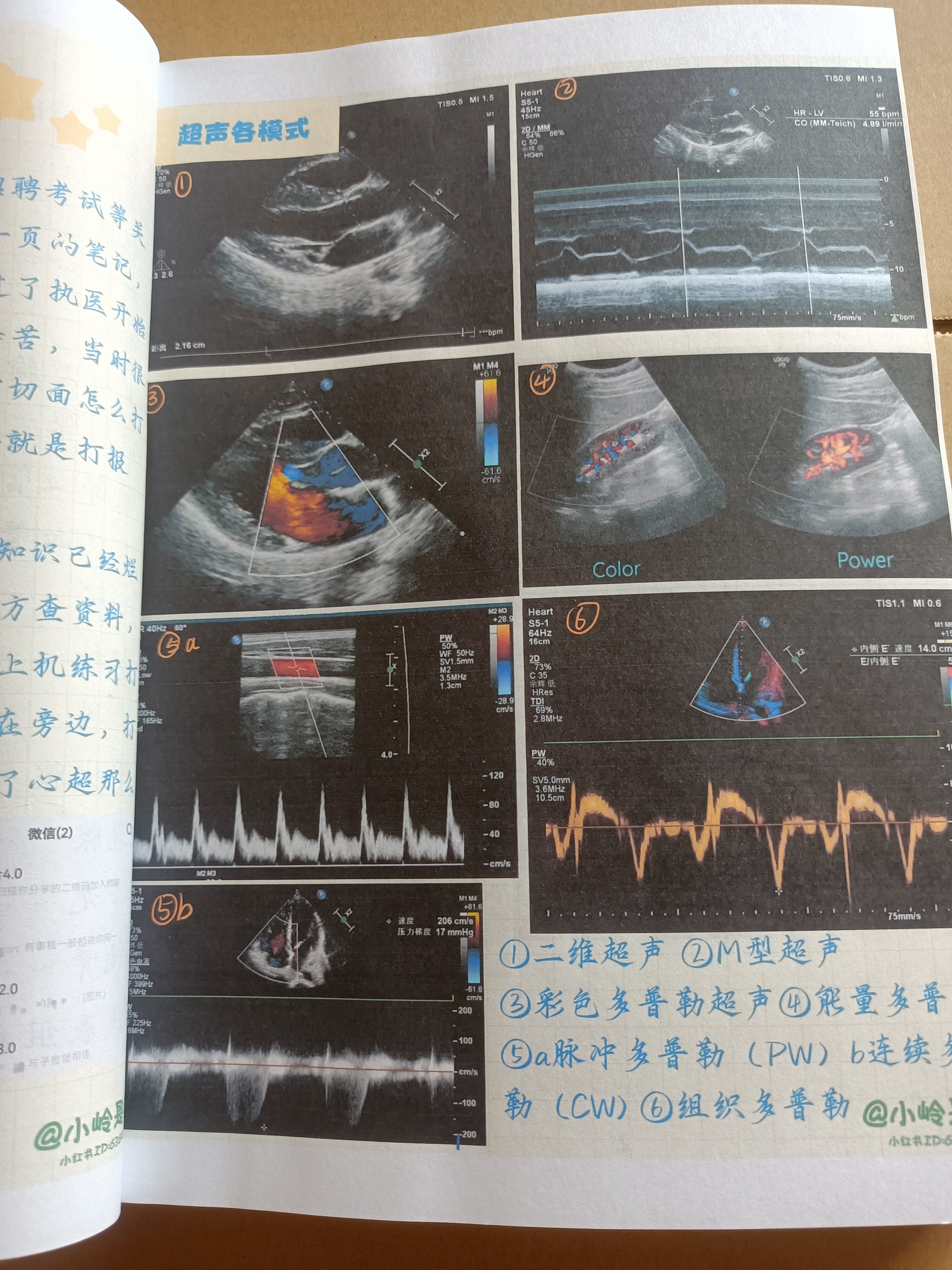 超声笔记医学诊断b超彩超入门掌课业本/教学用本