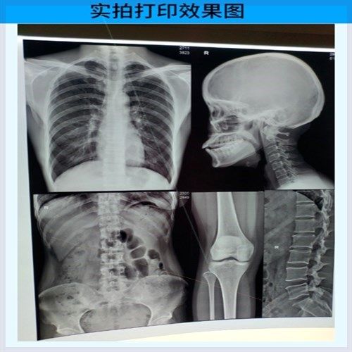 医用彩超X光片DR CT胶片代其它