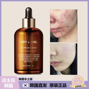LORY&CHEL光彩发酵舒缓精华光滑纹理保湿 提亮肤色80g 韩国直邮