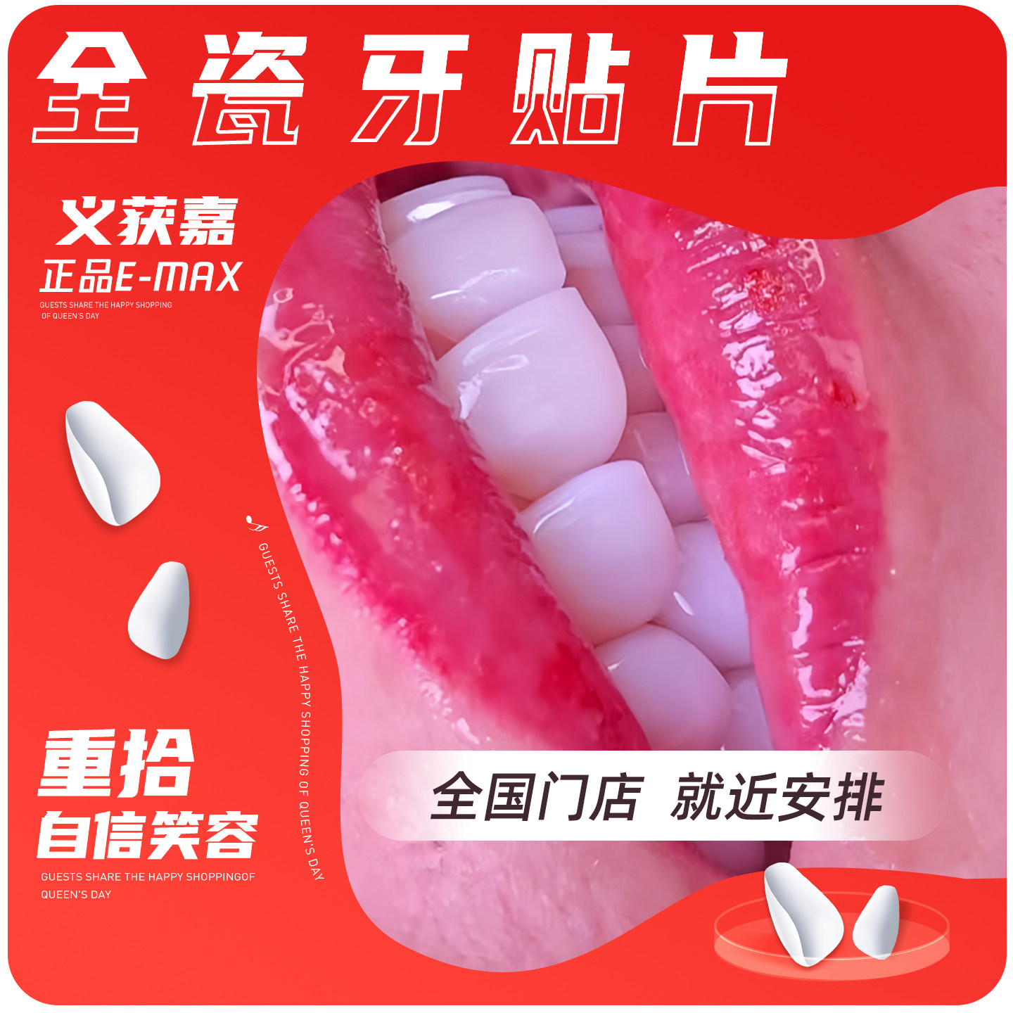 义获嘉EMAX全瓷贴面全瓷牙贴电子美牙产品