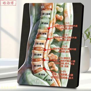 腰椎节段神经放射痛定位科普相框摆台骨科医院腰腿痛诊断装饰摆件