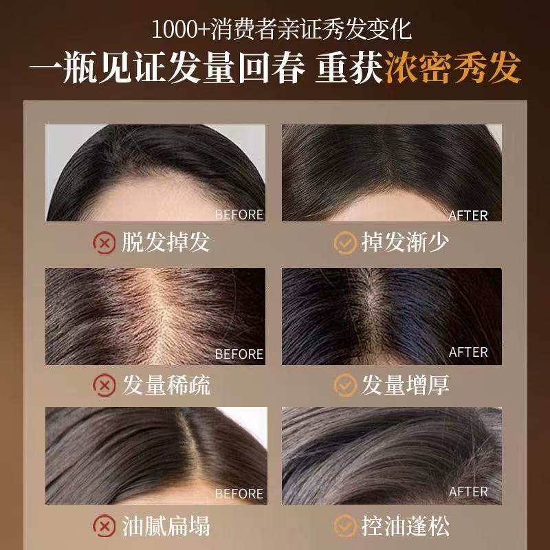 侧柏叶防脱固发洗发水人参何首乌控油蓬松去屑止痒柔顺亮泽洗发露