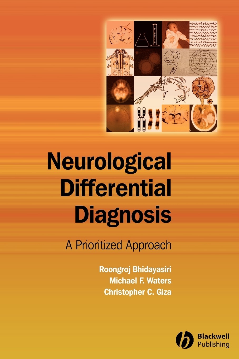 【预售 按需印刷】neurological differential diagnosis