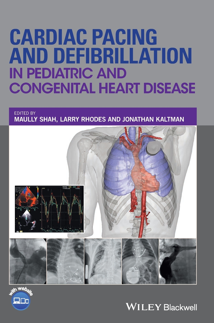 【预售按需印刷】Cardiac Pacing and Defibrillation in Pediatric and Congenital Heart Disease