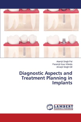 预售 按需印刷 Diagnostic Aspects and Treatment Planning in Implants
