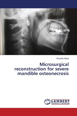 预售 按需印刷 Microsurgical reconstruction for severe mandible osteonecrosis