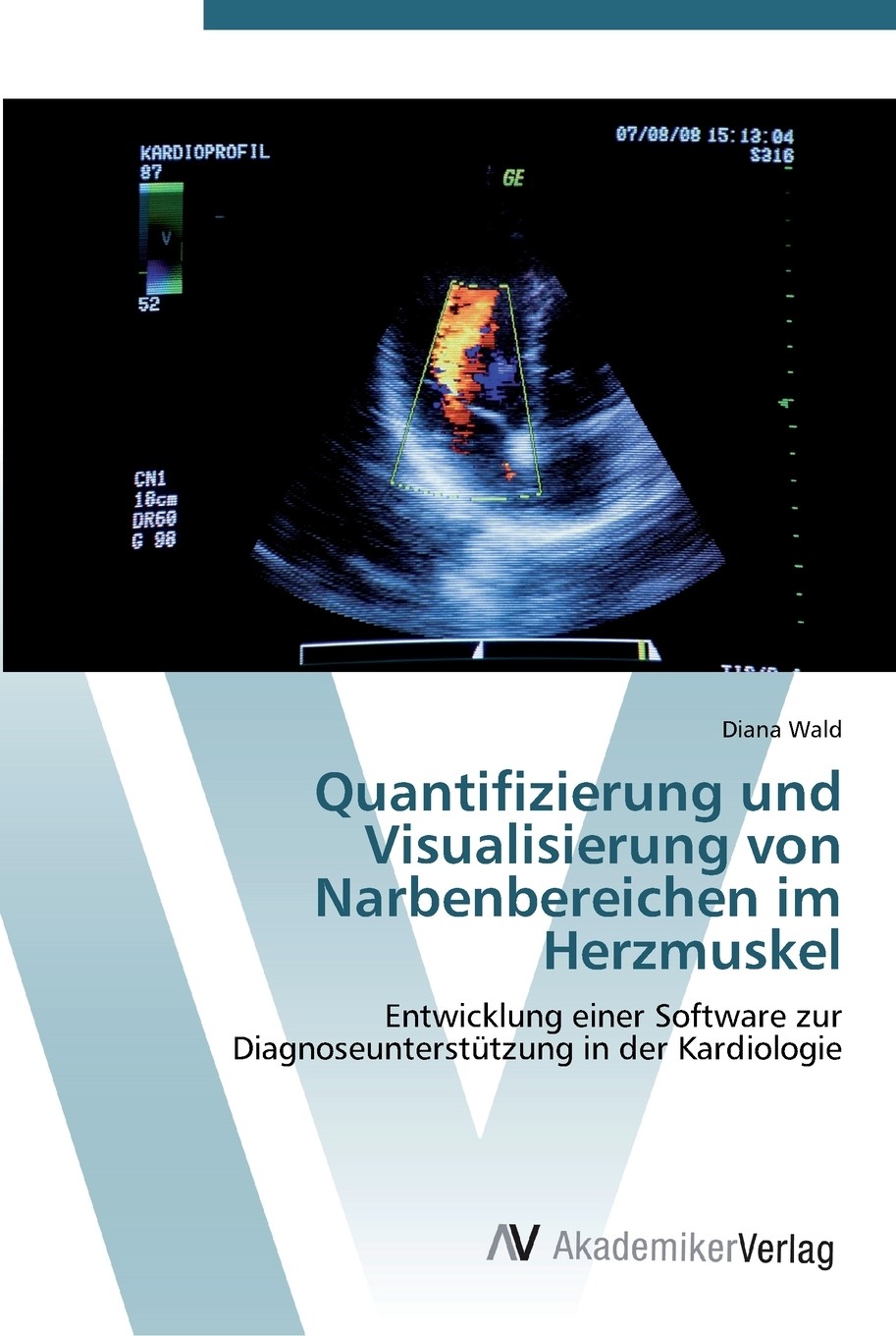 预售 按需印刷quantifizierung und visualisierung von narben