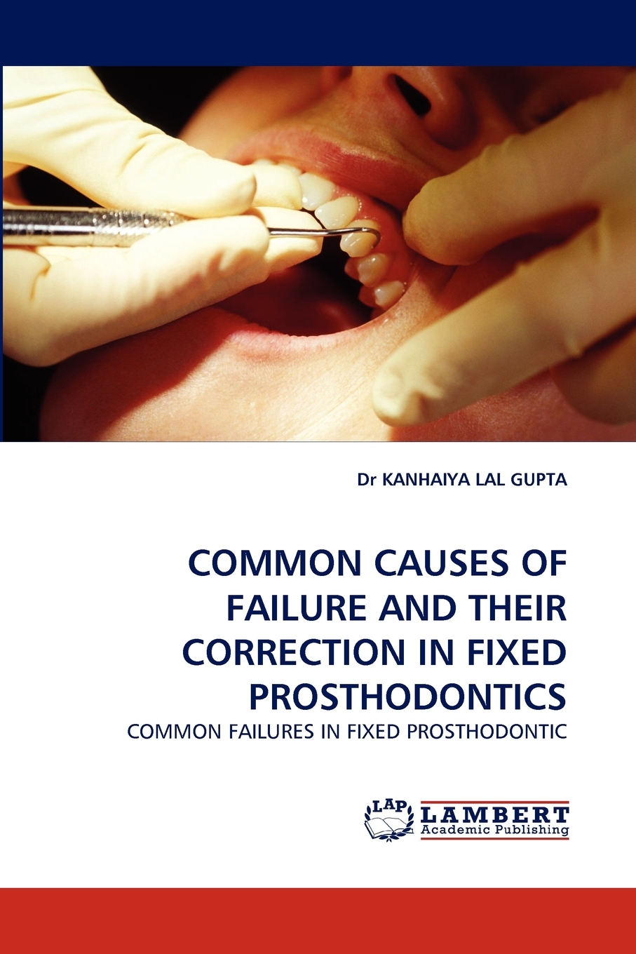 【预售 按需印刷】Common Causes of Failure and Their Correction in Fixed Prosthodontics 书籍/杂志/报纸 原版其它 原图主图