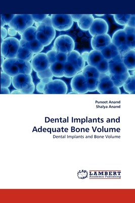 【预售 按需印刷】Dental Implants and Adequate Bone Volume