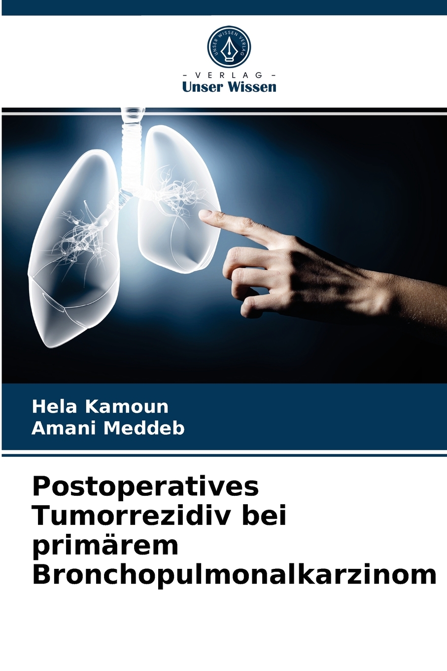 预售按需印刷Postoperatives Tumorrezidiv bei prim?rem Bronchopulmonalkarzinom德语ger