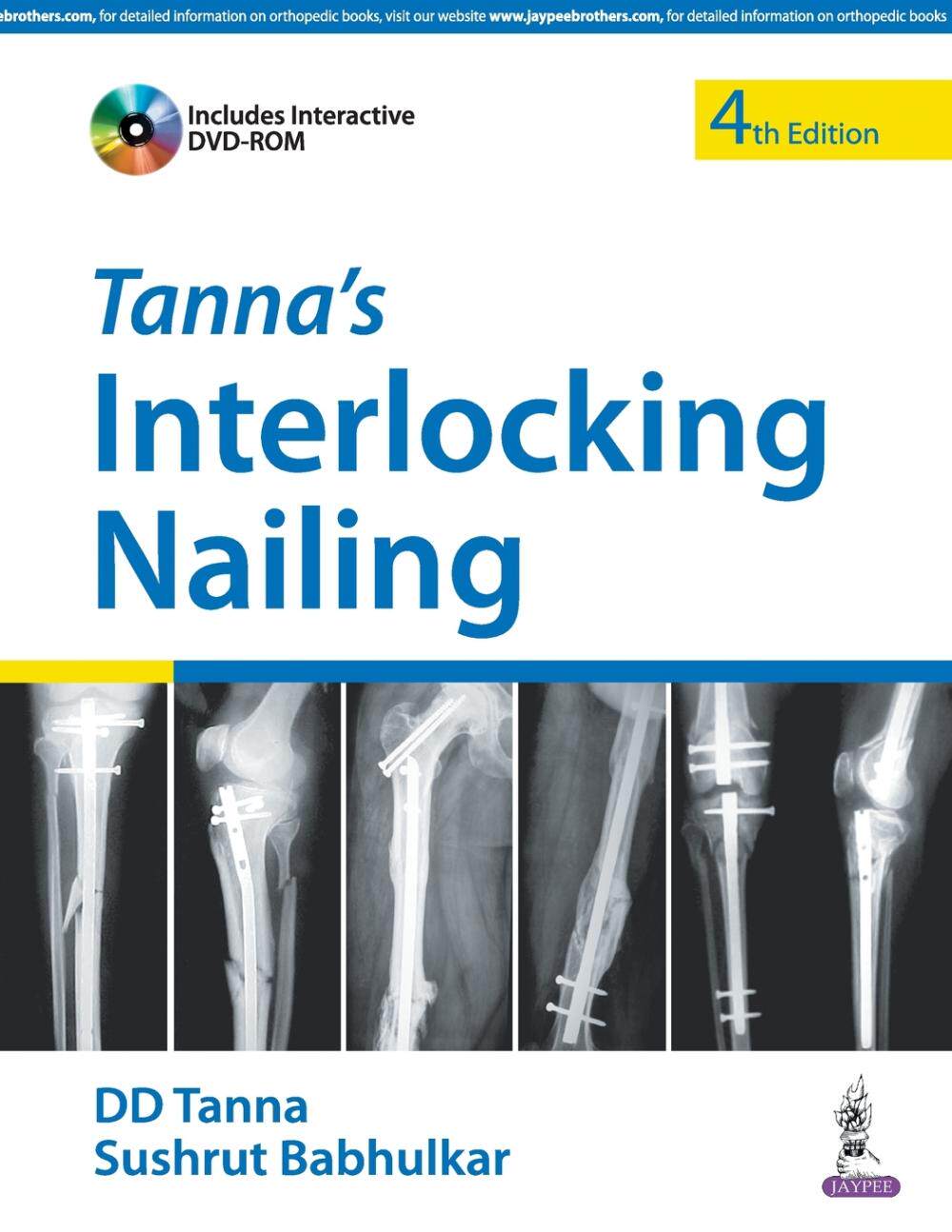 【预售 按需印刷】tanna s interlocking nailing with dvd-rom
