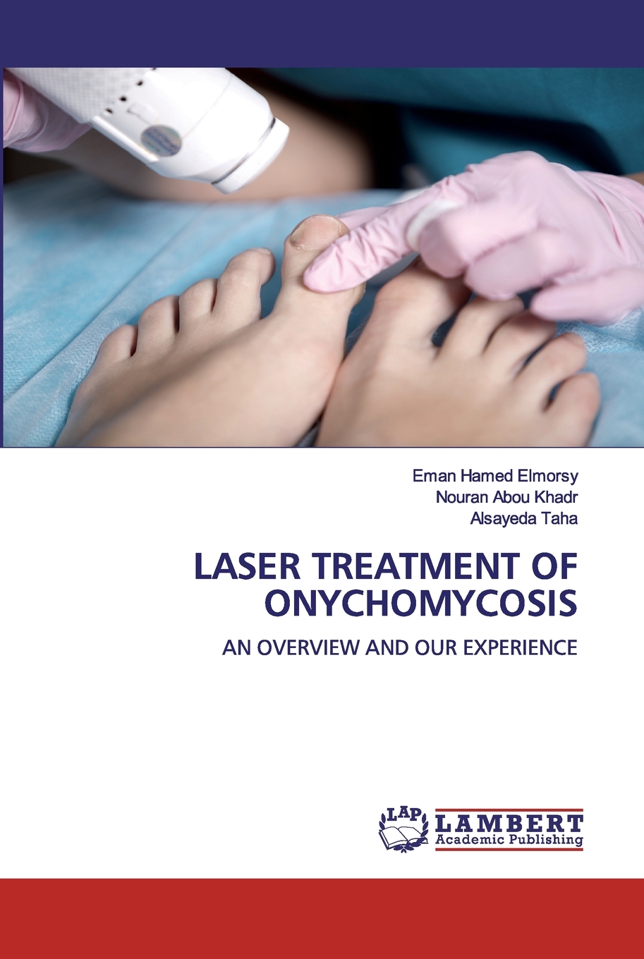 预售 按需印刷 LASER TREATMENT OF ONYCHOMYCOSIS