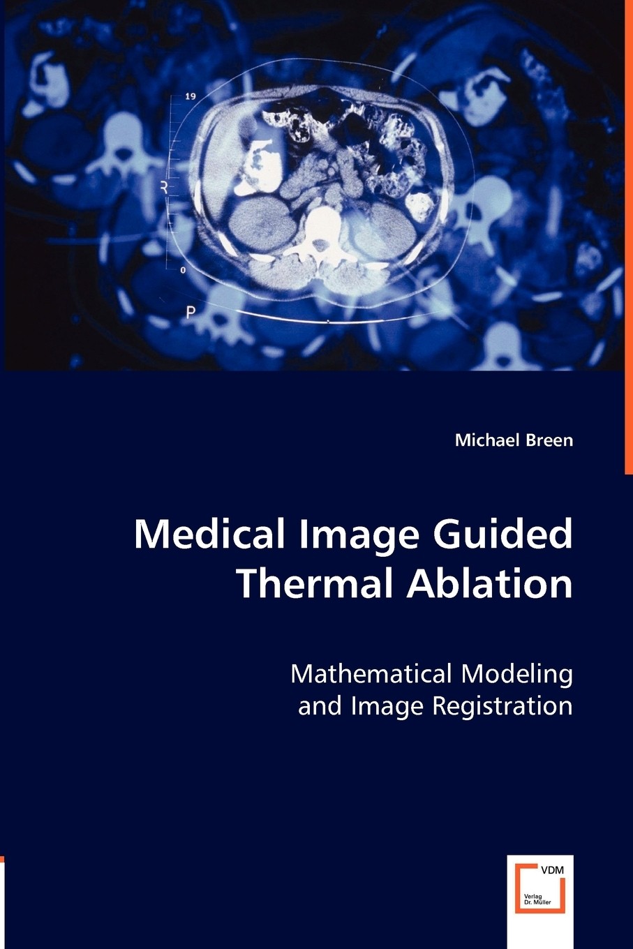 【预售 按需印刷】medical image guided thermal ablation