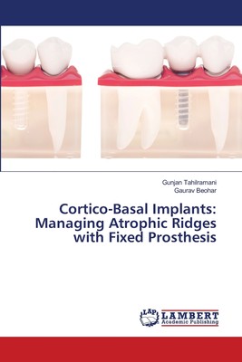 预售 按需印刷Cortico-Basal Implants