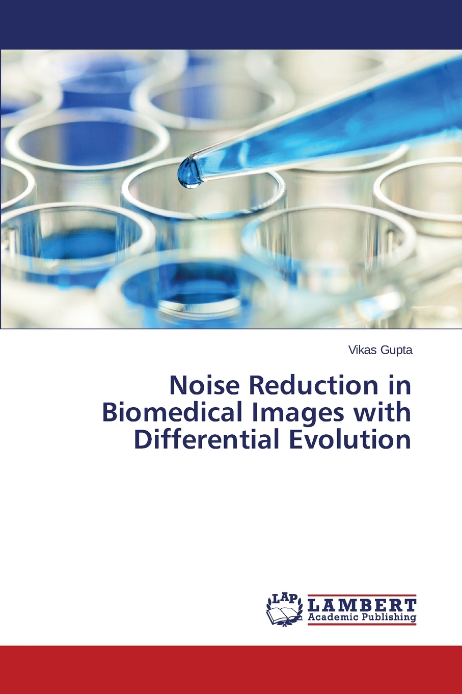 【预售 按需印刷】Noise Reduction in Biomedical Images with Differential Evolution 书籍/杂志/报纸 原版其它 原图主图