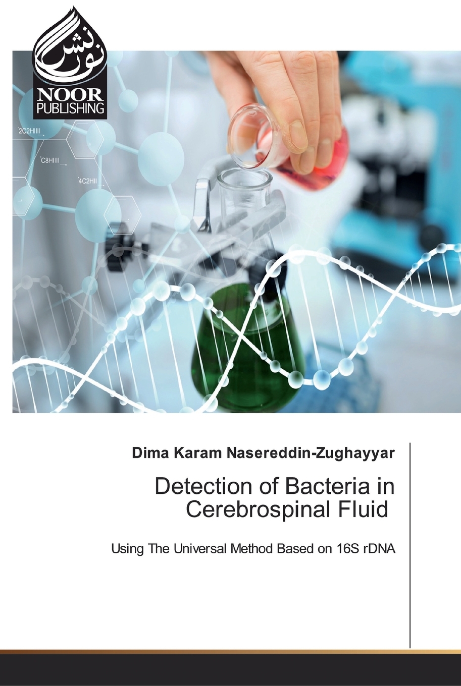 【预售按需印刷】Detection of Bacteria in Cerebrospinal Fluid