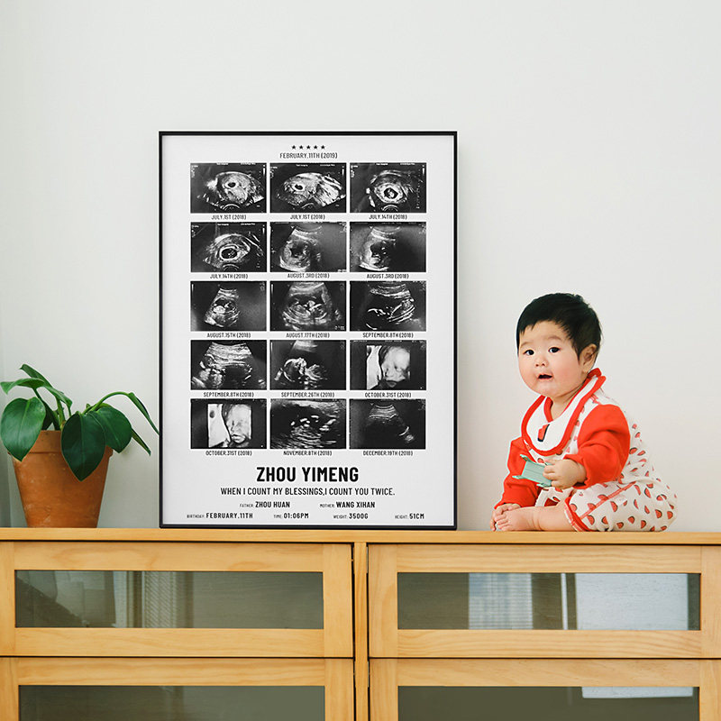青空馆宝宝b超图组合相框孕期纪念画框定制婴儿baby高清照片打印