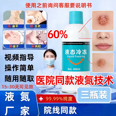液氮级冷冻去优液态冷冻喷雾小瓶装官方正品迅速冷冻家庭版玥羲牌
