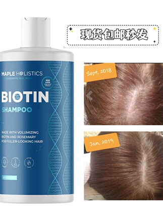 In-Stock Large 473ml Biotin Anti-Hair Loss Shampoo from the Usa, Specifically for Dry, Fine, Damaged, and Thinning Hair