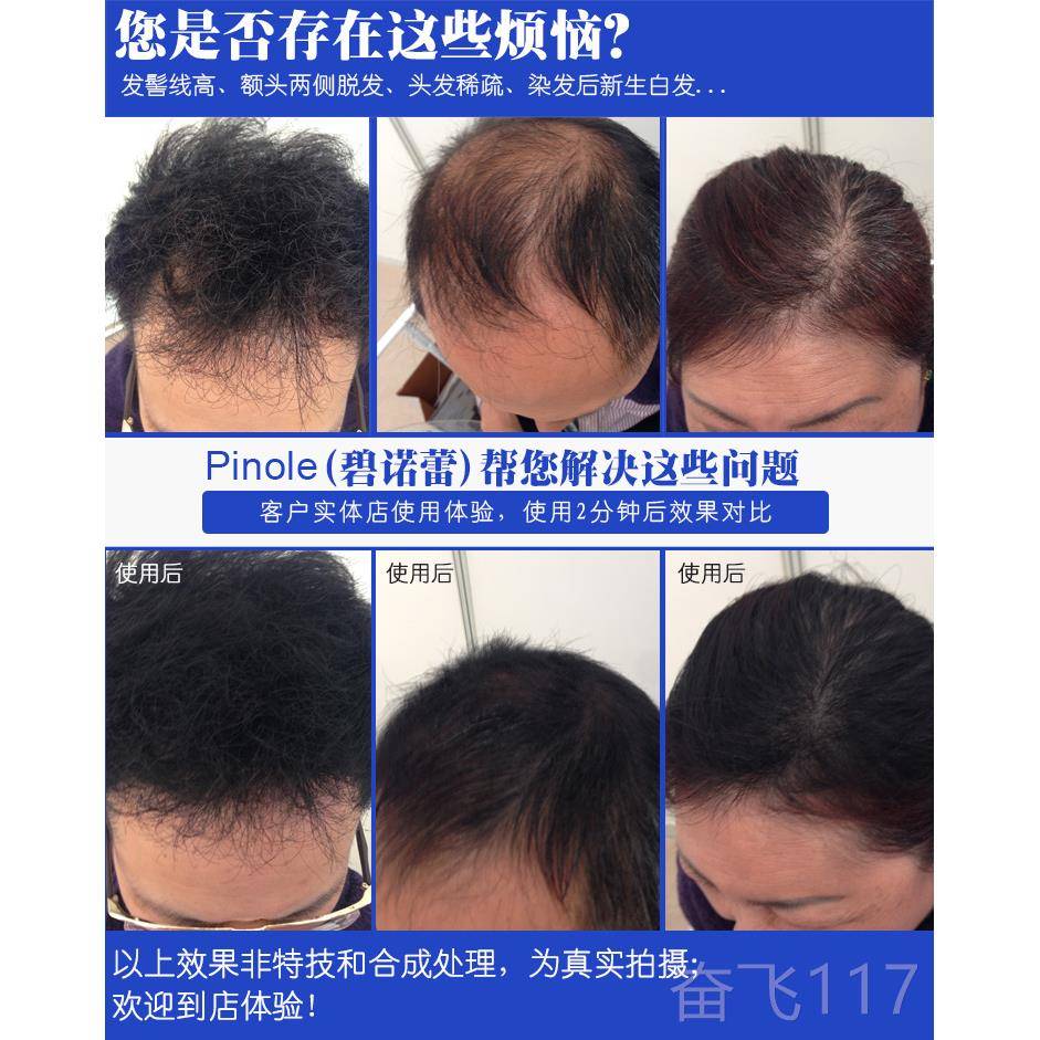 正品日本V-UP碳粉补遮发粉假发神器男际女增发加头发密发纤维线喷