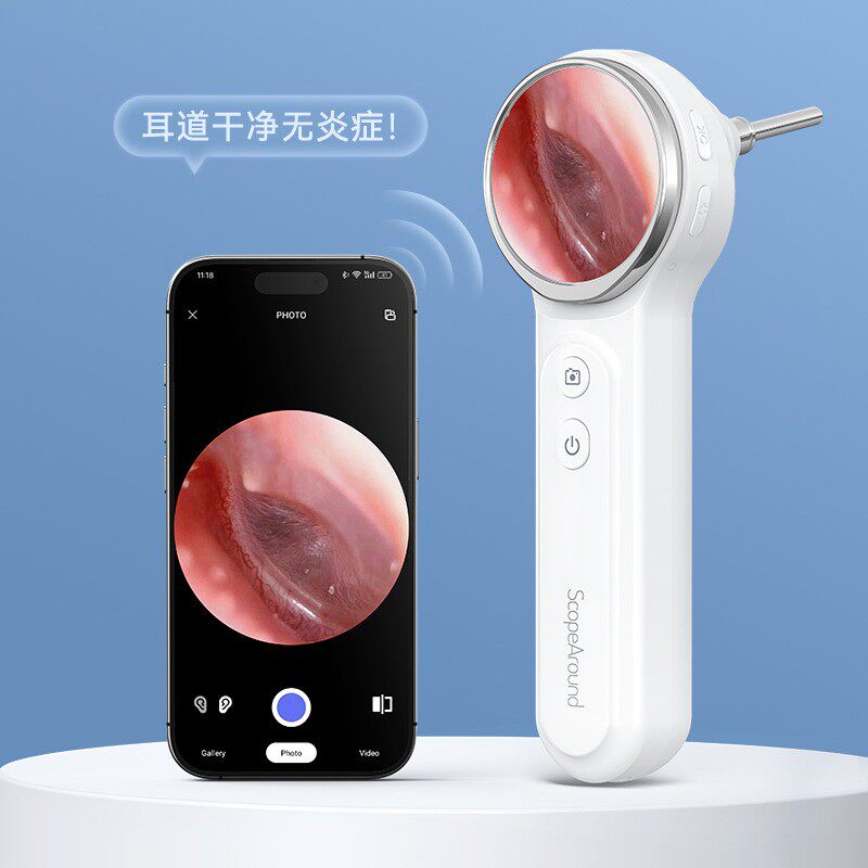 可视检耳镜无线接手机电耳镜手握采耳灯高清耳镜掏耳朵耳鼻喉通用
