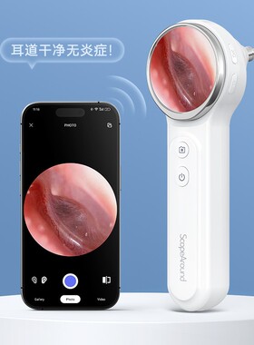 可视检耳镜无线接手机电耳镜手握采耳灯高清耳镜掏耳朵耳鼻喉通用
