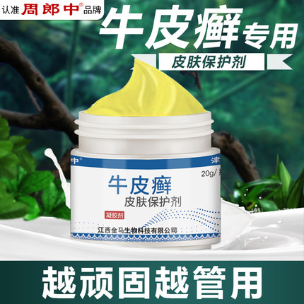 牛皮癣型手足大腿内侧股体银屑皮肤外用膏专用抑菌癣膏